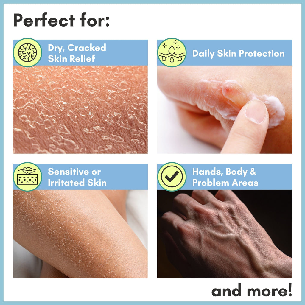 Skin Repair Cream for Dry, Cracked Hands, Feet & Elbows